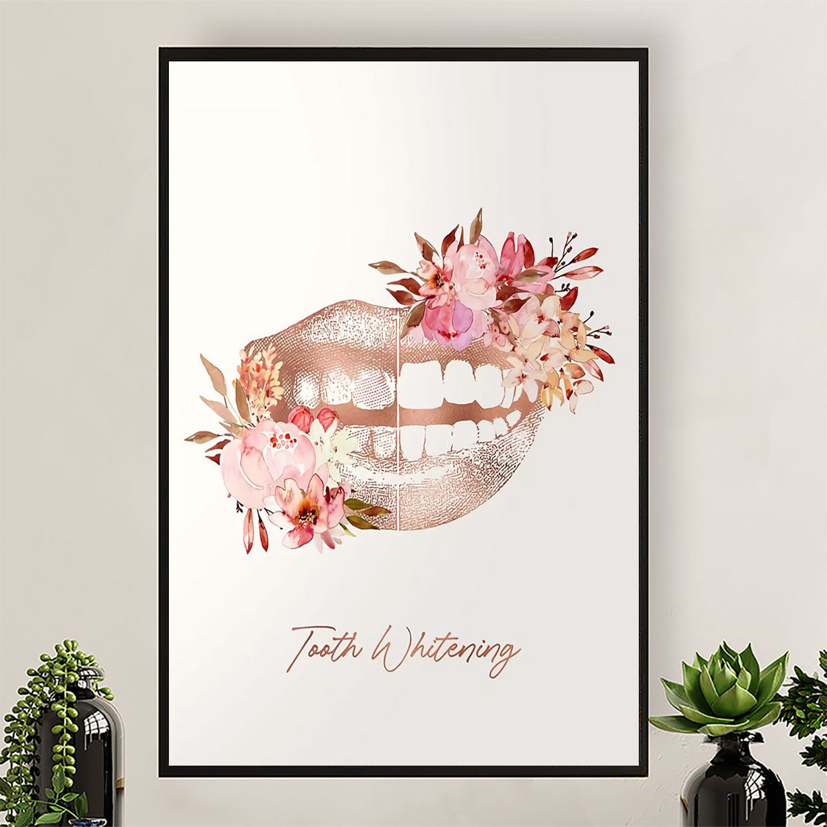 Dental Poster Tooth Whitening | Wall Art Gift for Dentist