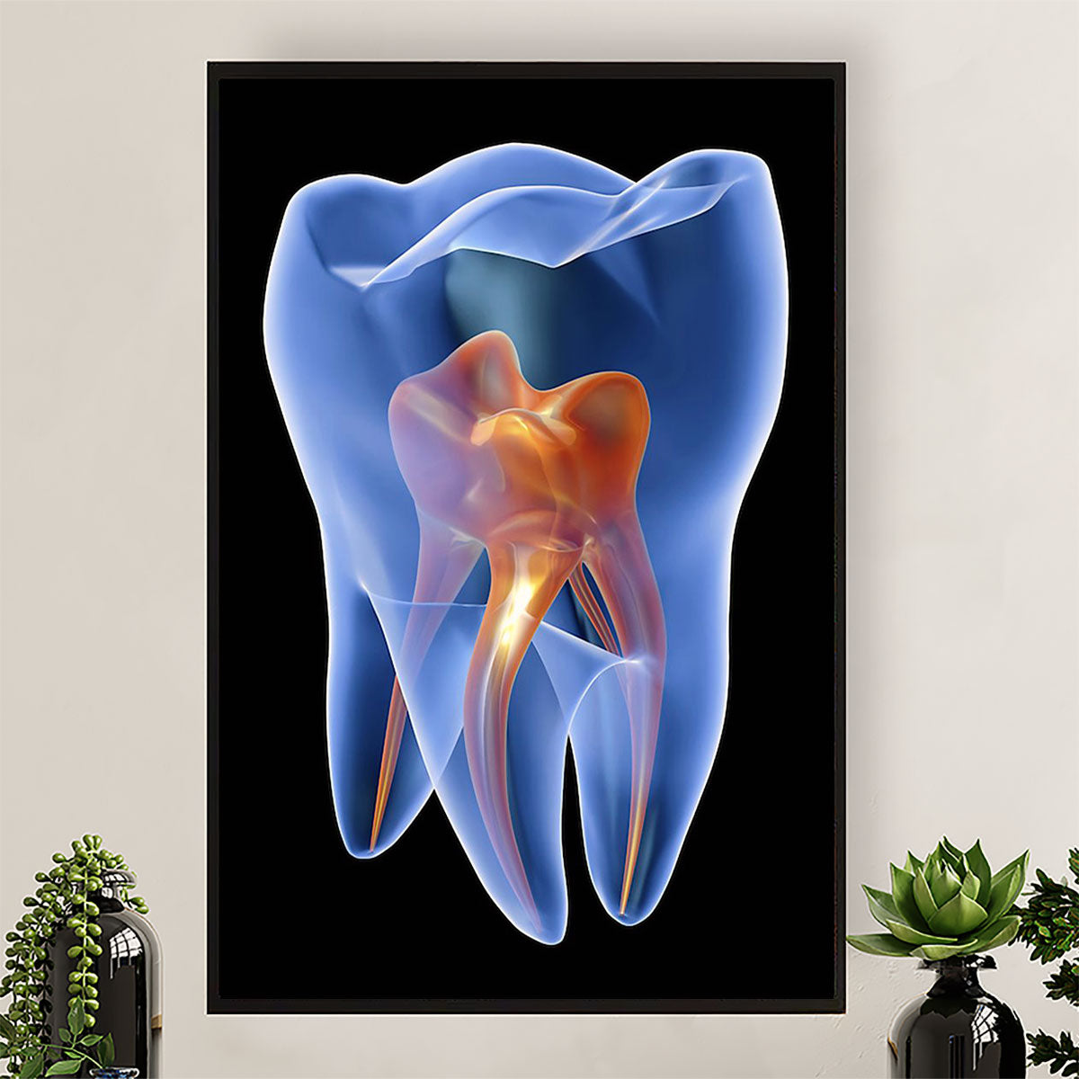 Dental Canvas Tooth Implant | Wall Art Gift for Dentist