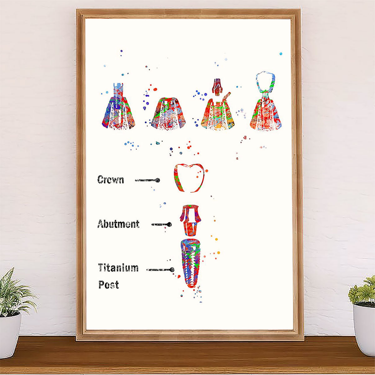 Dental Poster Implant Procedure | Wall Art Gift for Dentist