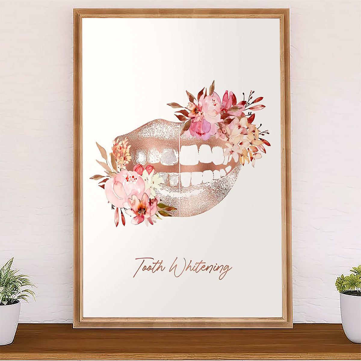 Dental Poster Tooth Whitening | Wall Art Gift for Dentist