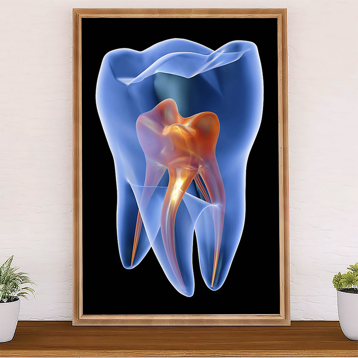 Dental Canvas Tooth Implant | Wall Art Gift for Dentist