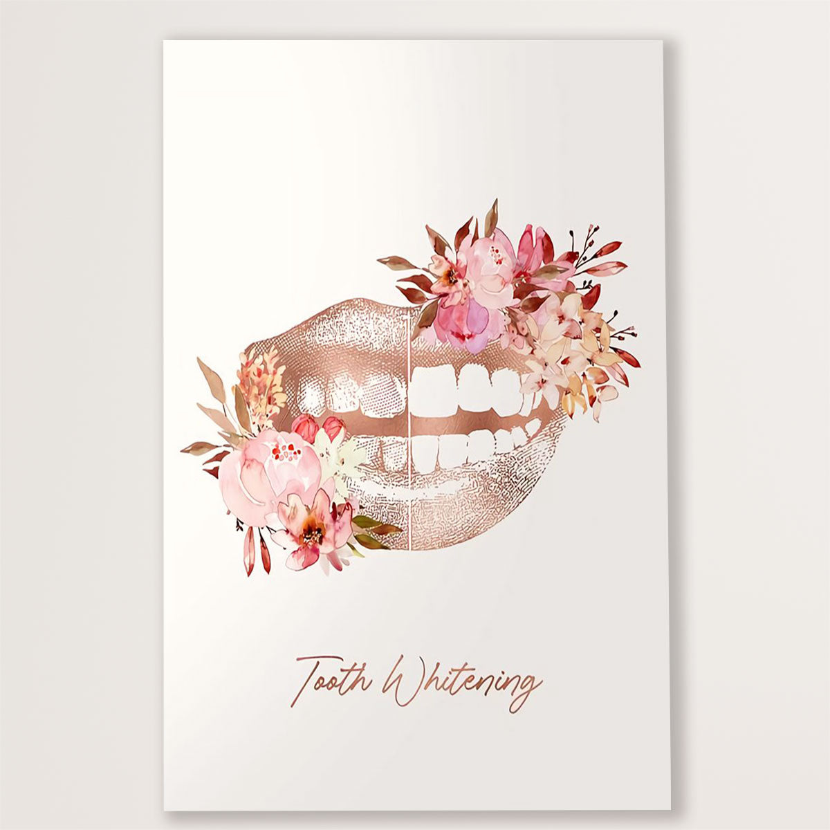 Dental Poster Tooth Whitening | Wall Art Gift for Dentist