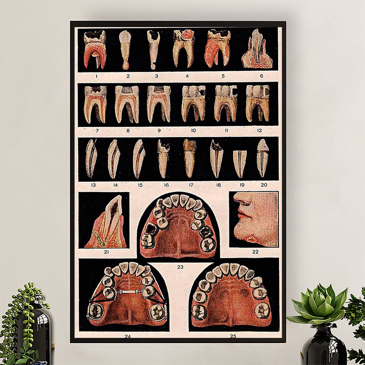 Dental Canvas Tooth Pattern | Wall Art Gift for Dentist
