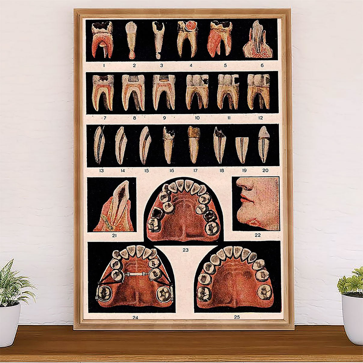 Dental Canvas Tooth Pattern | Wall Art Gift for Dentist