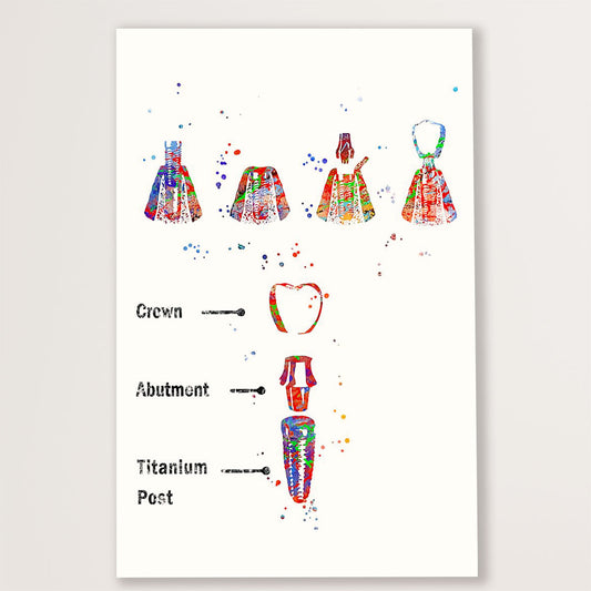 Dental Canvas Implant Procedure | Wall Art Gift for Dentist