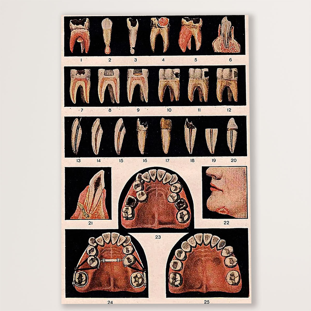 Dental Canvas Tooth Pattern | Wall Art Gift for Dentist