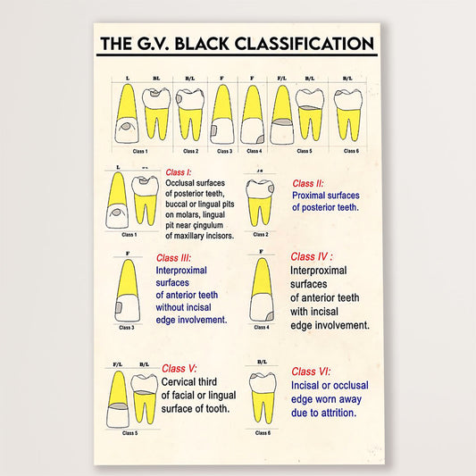 Dental Canvas The G.V Black Classification | Wall Art Gift for Dentist